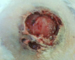 abscess with many different holes
