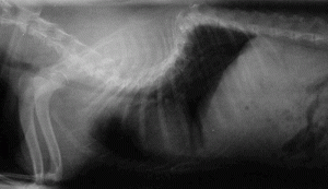 collapse of the spine x ray with hemivertebrae