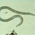 Hookworms are microscopic