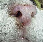Small scabs on the nose - skin cancer