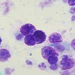 Mast cells contain blue granules of histamine and heparin