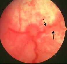 changes in the retina in an FIP cat