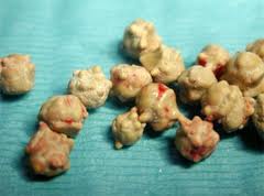 oxalate bladder stone in cats