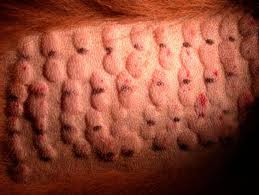 skin prick allergy tests