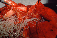Adult heartworms in pulmnary artery of a dog online vet