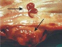 Red colored worm in esophagus - spirocerca lupi