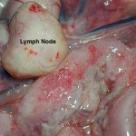enlarged lymph node fip
