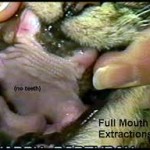 full mouth extraction