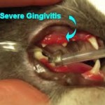 moderate to severe gingivitis